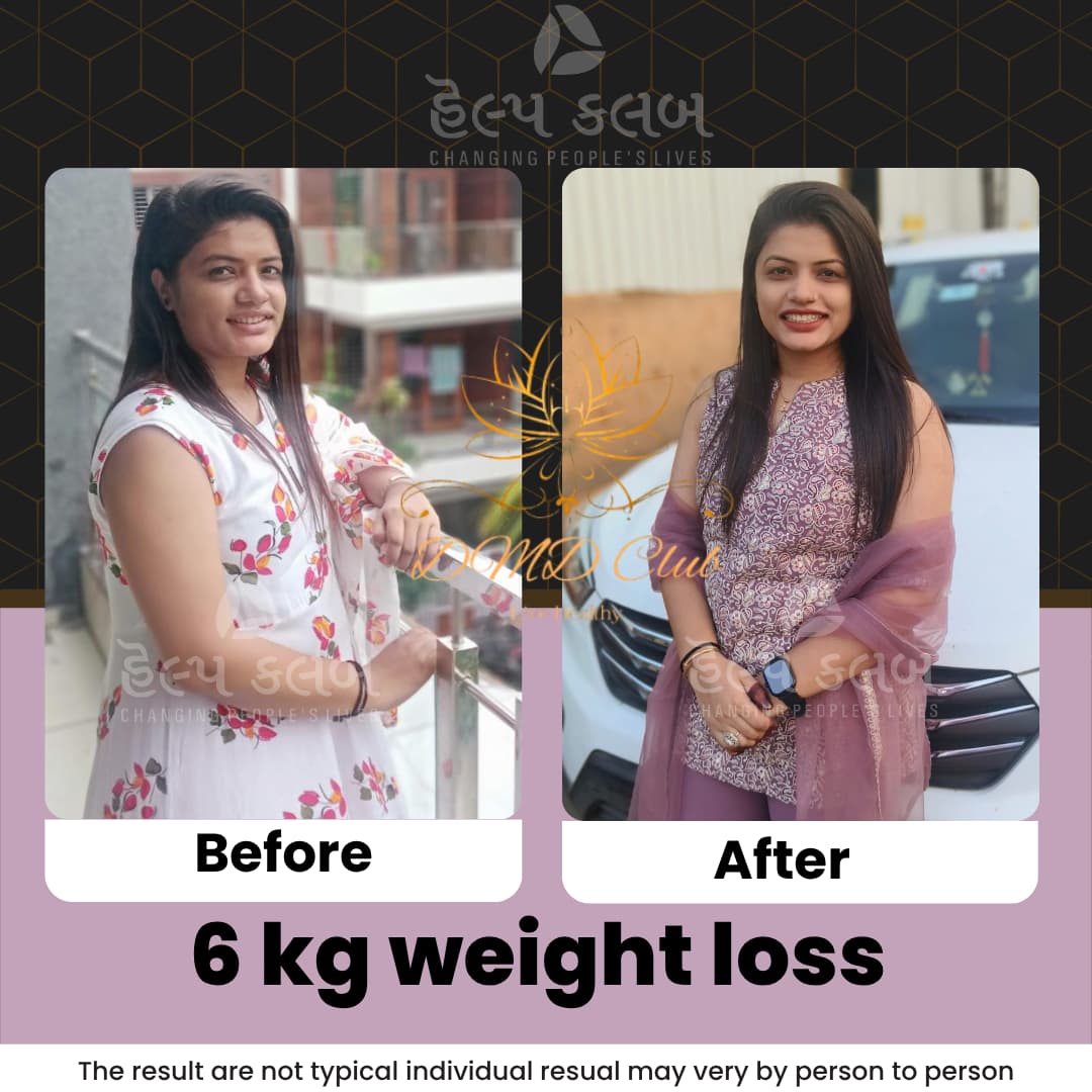 Wellness journey result 2 â€” member of DMD Club Healthy Varacha, shared with permission